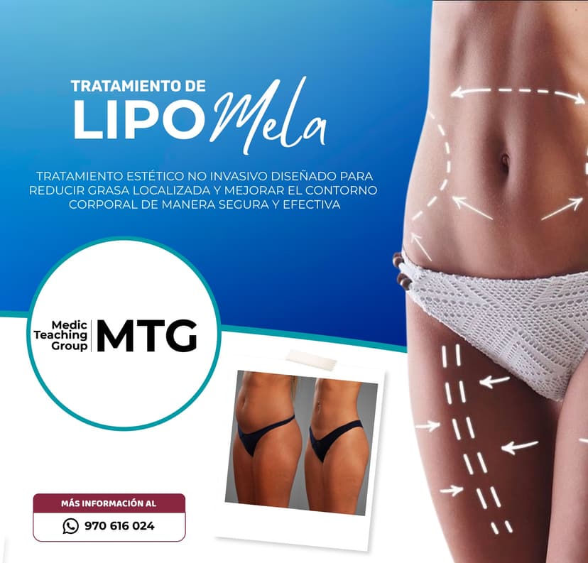 Body contouring procedure.